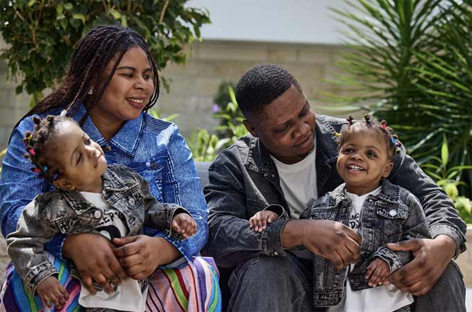 PureHealth hospital separates craniopagus twins...